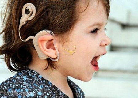 انجام ۱۳۲ عمل کاشت حلزون رایگان در تبریز